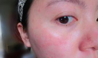 猫对花粉过敏吗 全国花粉过敏预警地图